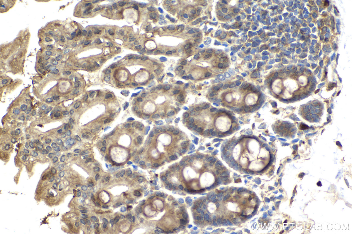 IHC staining of mouse intestine using 15531-1-AP