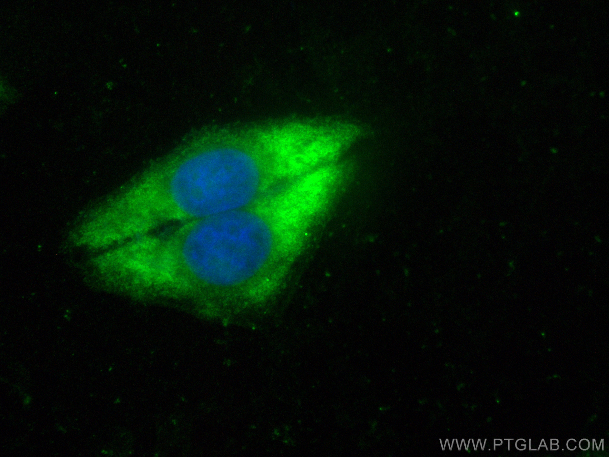 IF Staining of HepG2 using CL488-18295