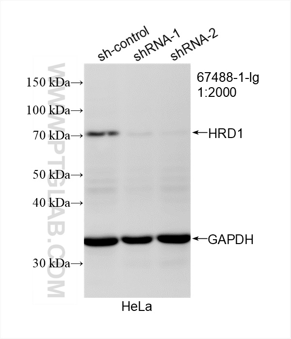 WB analysis of HeLa using 67488-1-Ig