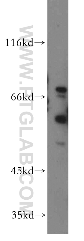 WB analysis of SH-SY5Y using 13414-1-AP