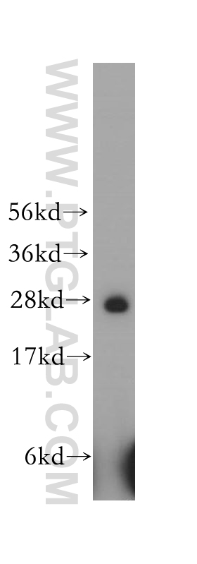 WB analysis of human liver using 12453-1-AP