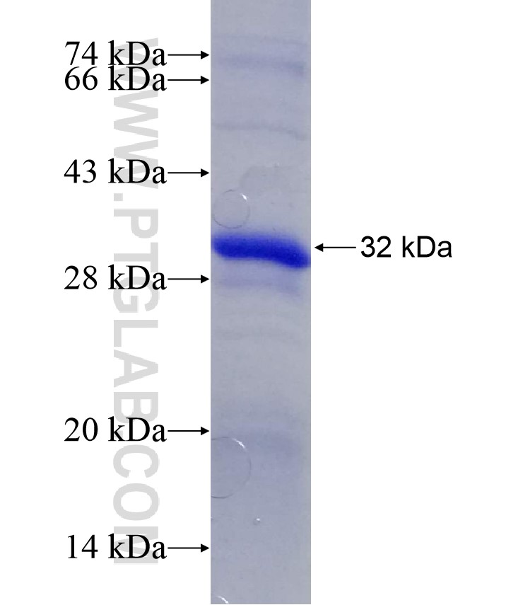 HSD11B1 fusion protein Ag29494 SDS-PAGE