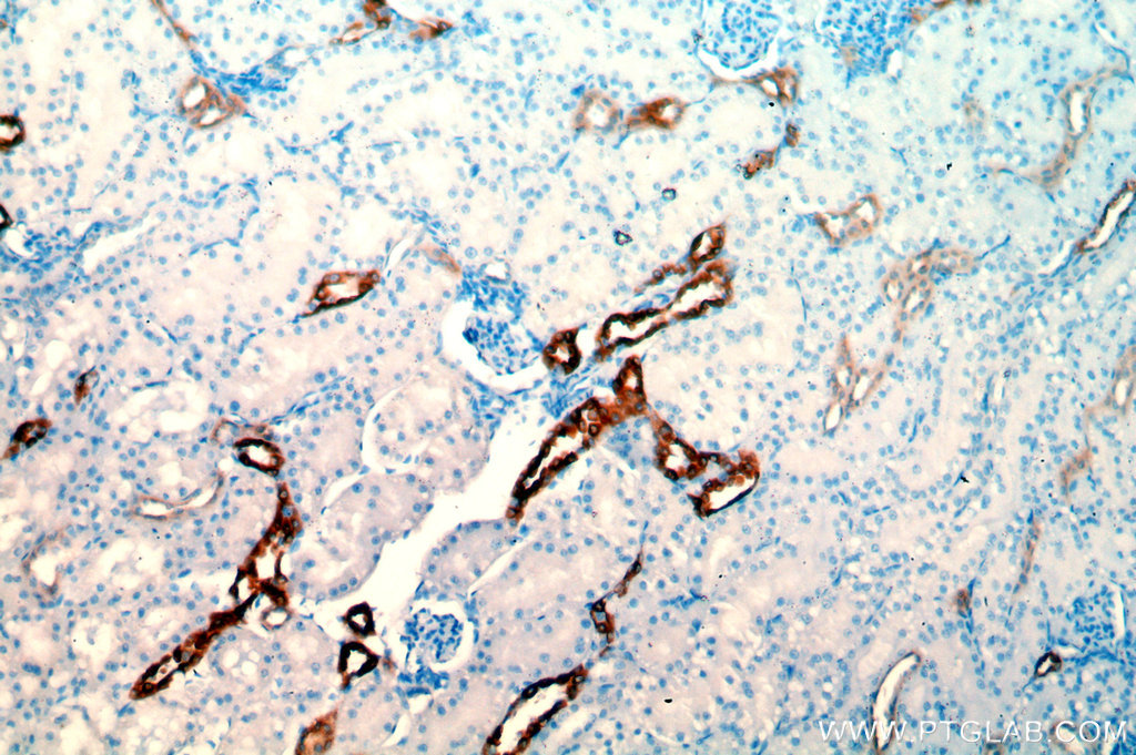 IHC staining of human kidney using 14192-1-AP