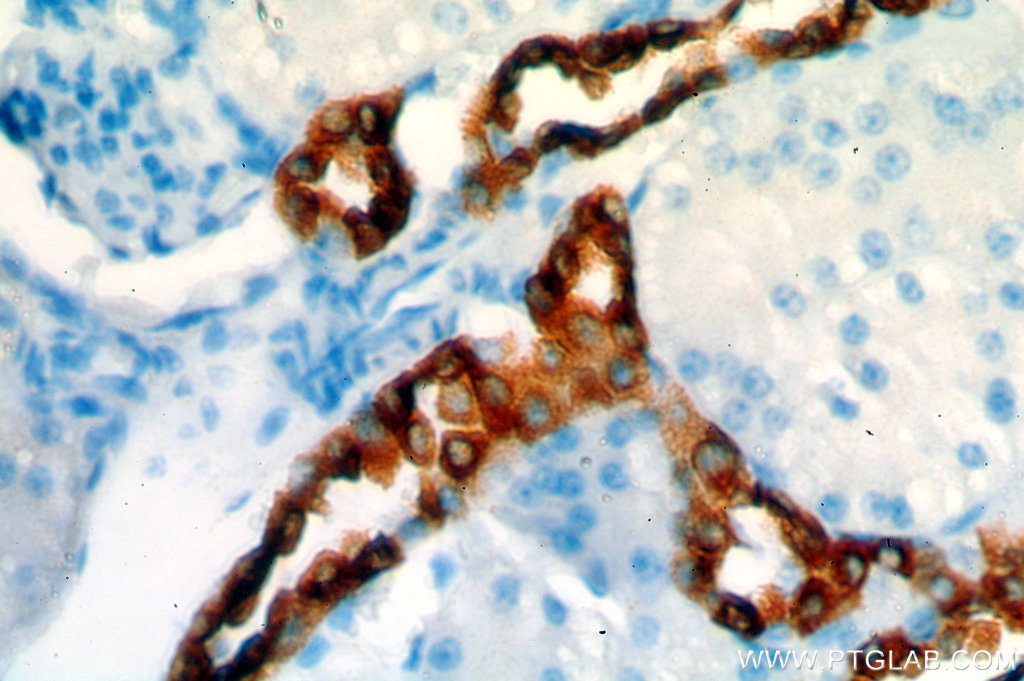 IHC staining of human kidney using 14192-1-AP