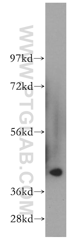 WB analysis of human kidney using 14192-1-AP