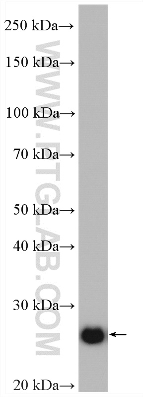 WB analysis of HeLa using 10648-1-AP