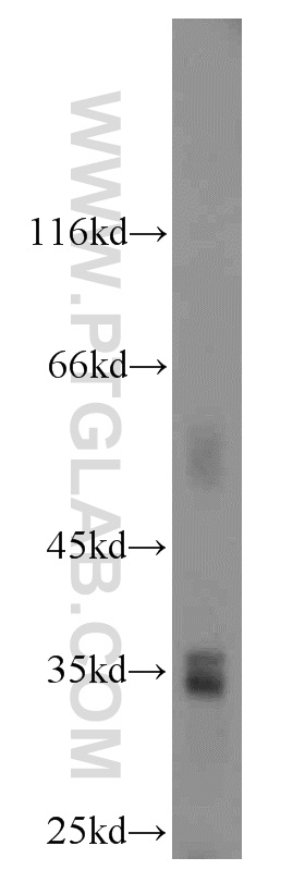 WB analysis of L02 using 16303-1-AP