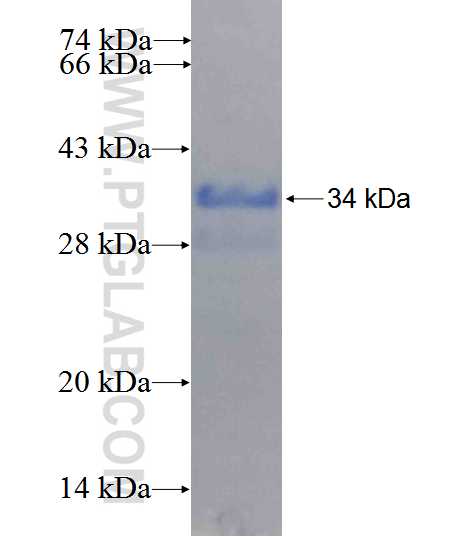 HSD17B12 fusion protein Ag26540 SDS-PAGE