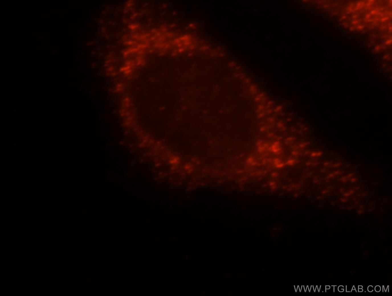 IF Staining of HeLa using 15116-1-AP