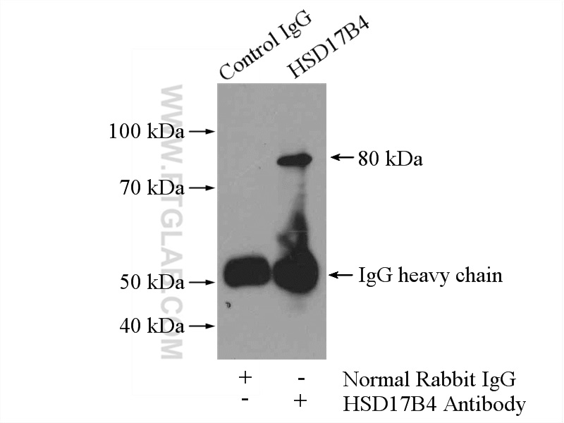 IP experiment of mouse brain using 15116-1-AP