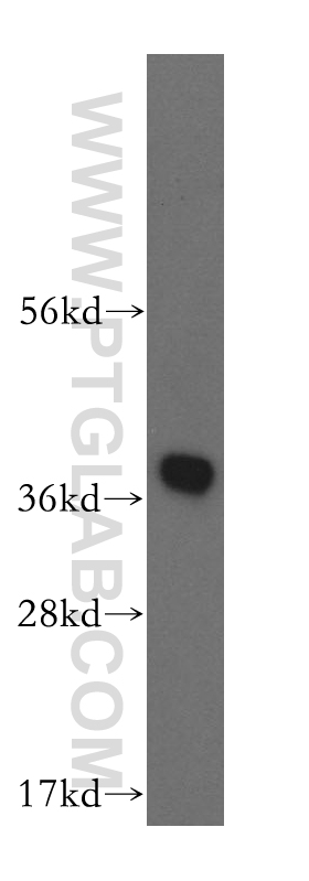 WB analysis of human liver using 16925-1-AP