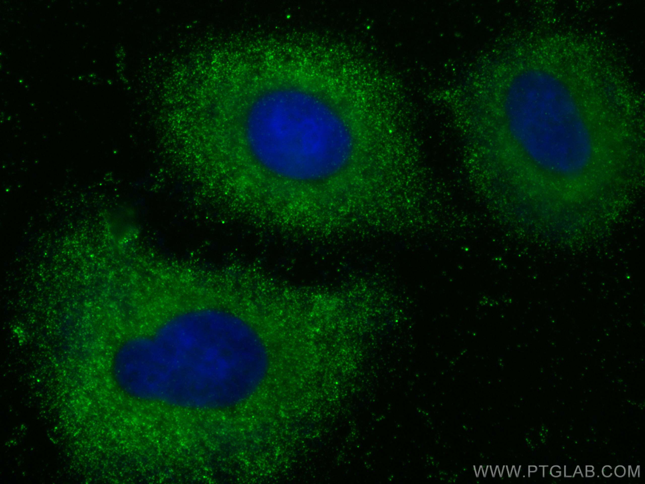 IF Staining of A549 using 67572-1-Ig