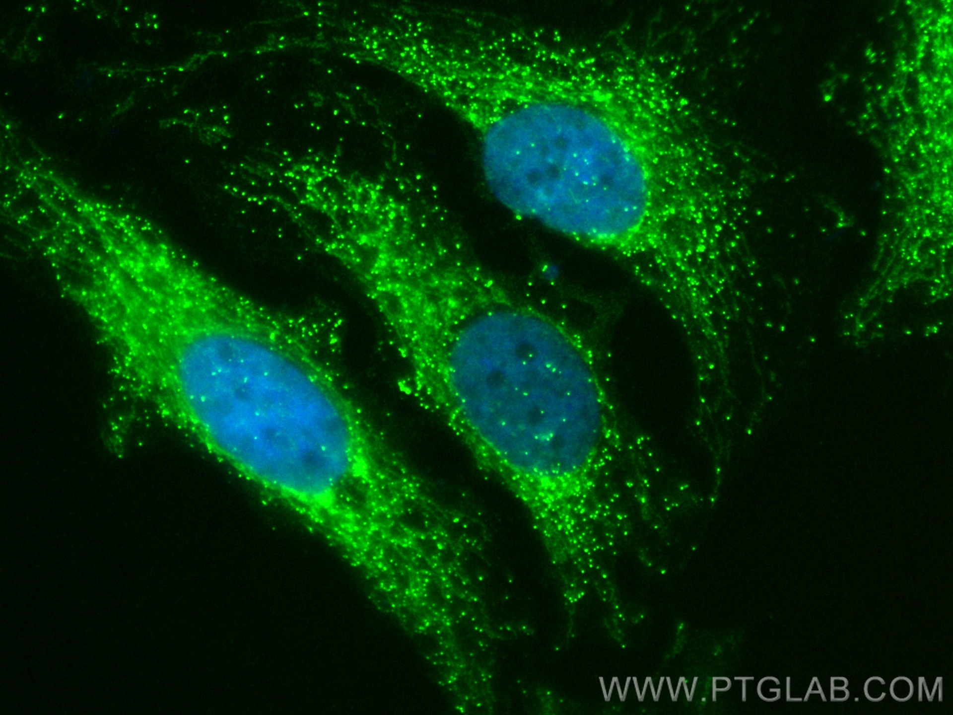 IF Staining of HeLa using CL488-15631