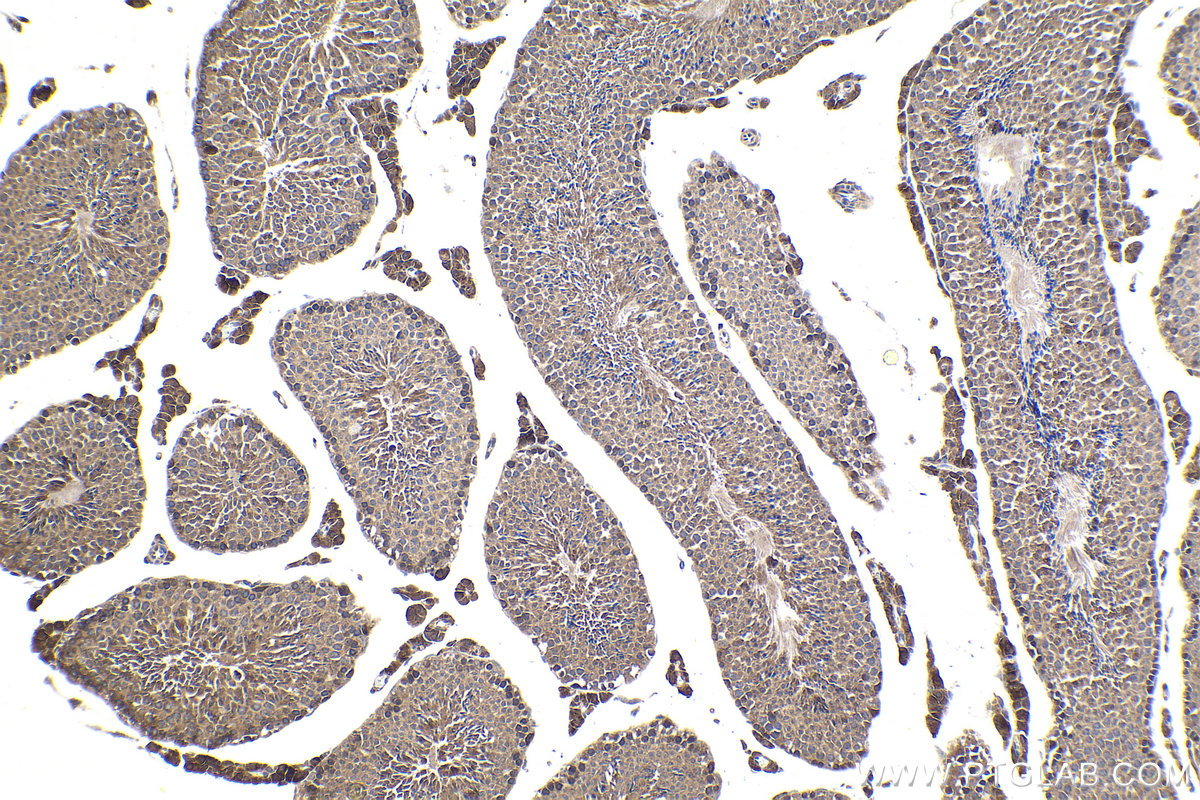 IHC staining of mouse testis using 10706-1-AP