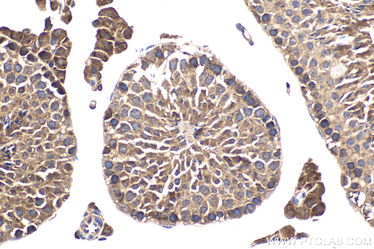 IHC staining of mouse testis using 10706-1-AP