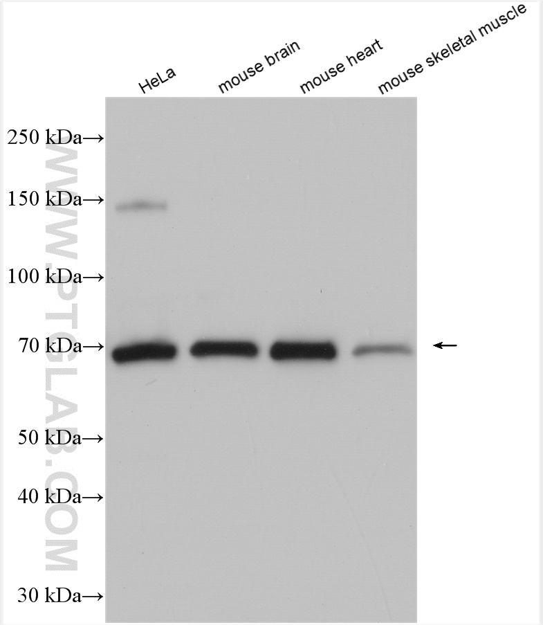 WB analysis using 22883-1-AP