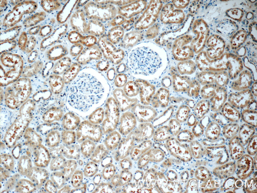 IHC staining of human kidney using 24055-1-AP