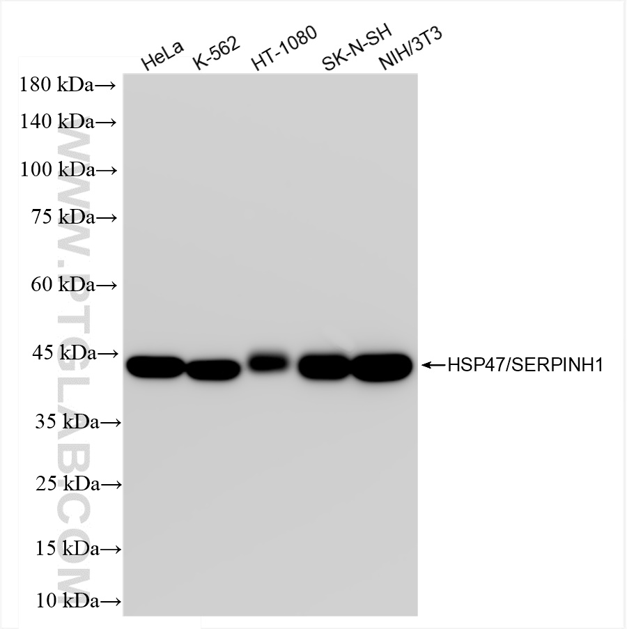 WB analysis using 83689-3-RR (same clone as 83689-3-PBS)