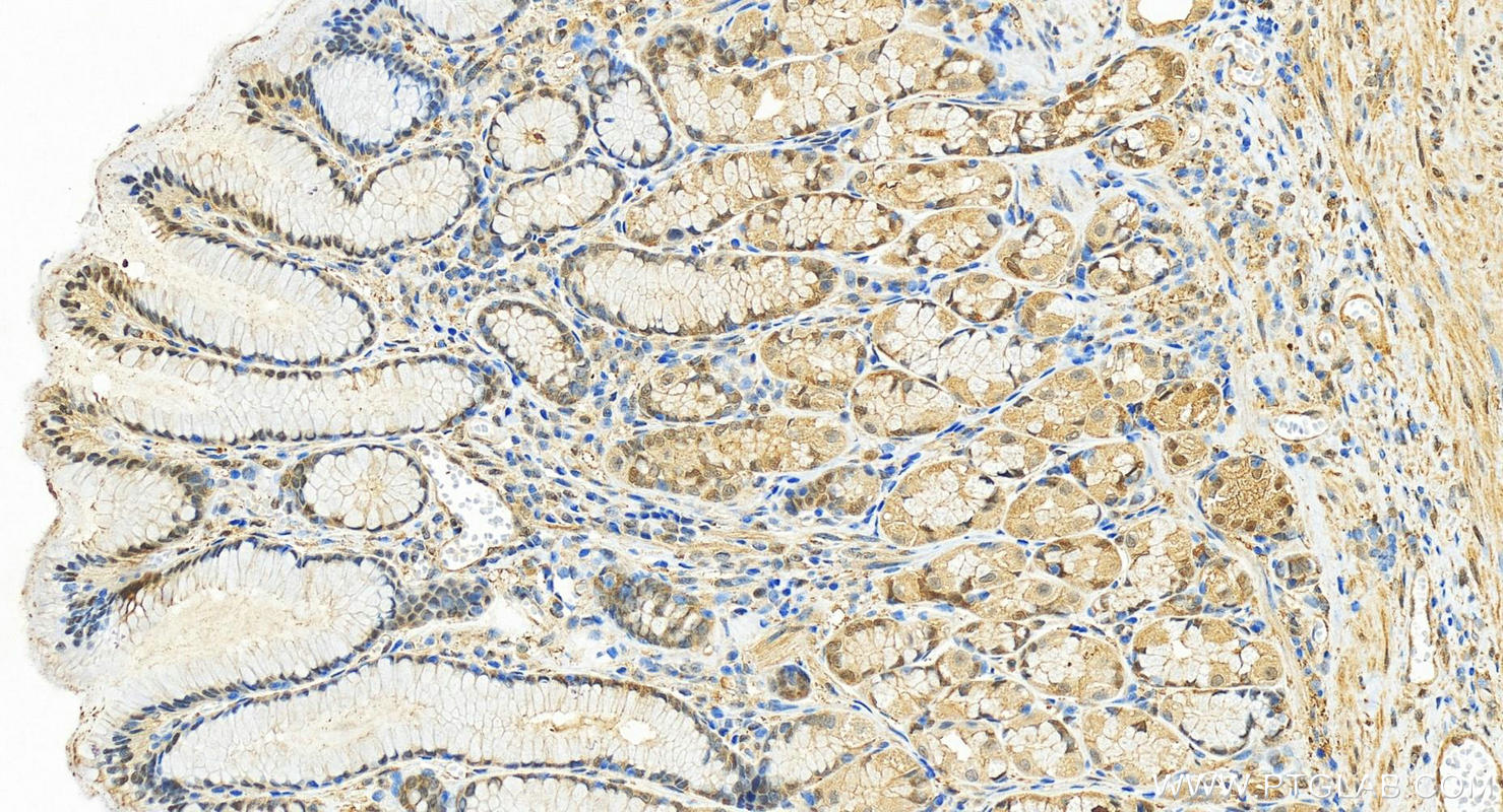 IHC staining of human stomach using 25405-1-AP