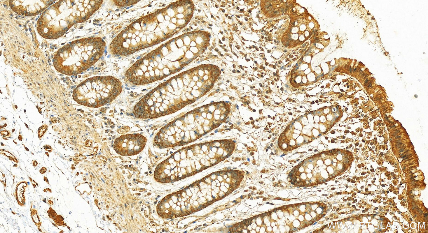 IHC staining of human colon using 13171-1-AP