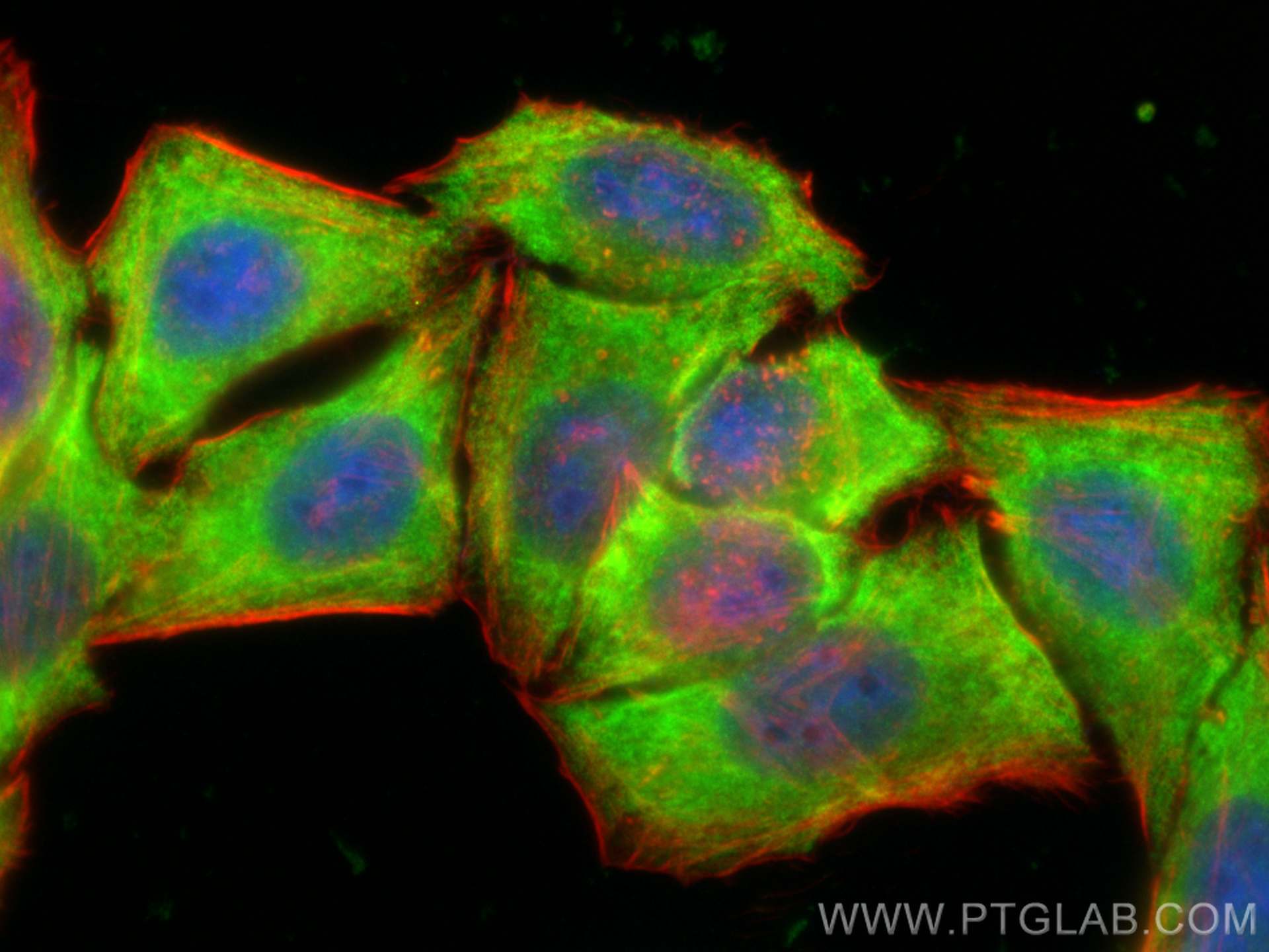 IF Staining of HepG2 using 13171-1-AP