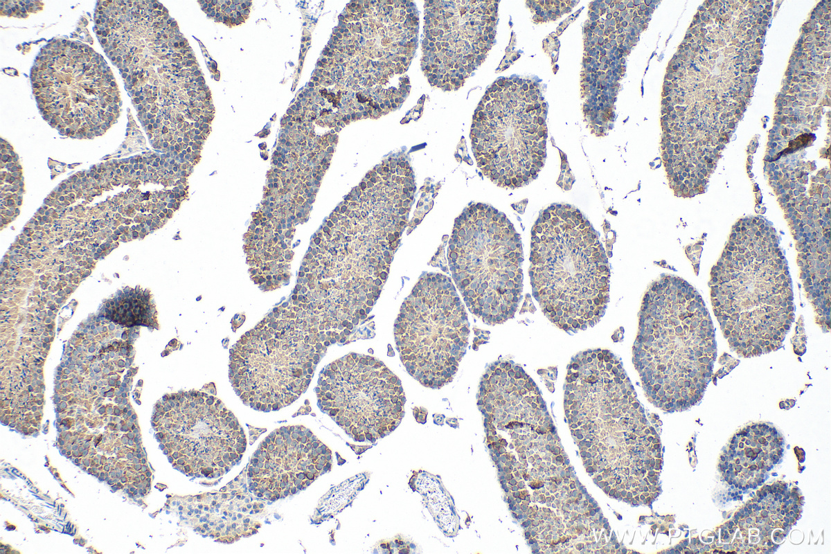 IHC staining of mouse testis using 13171-1-AP