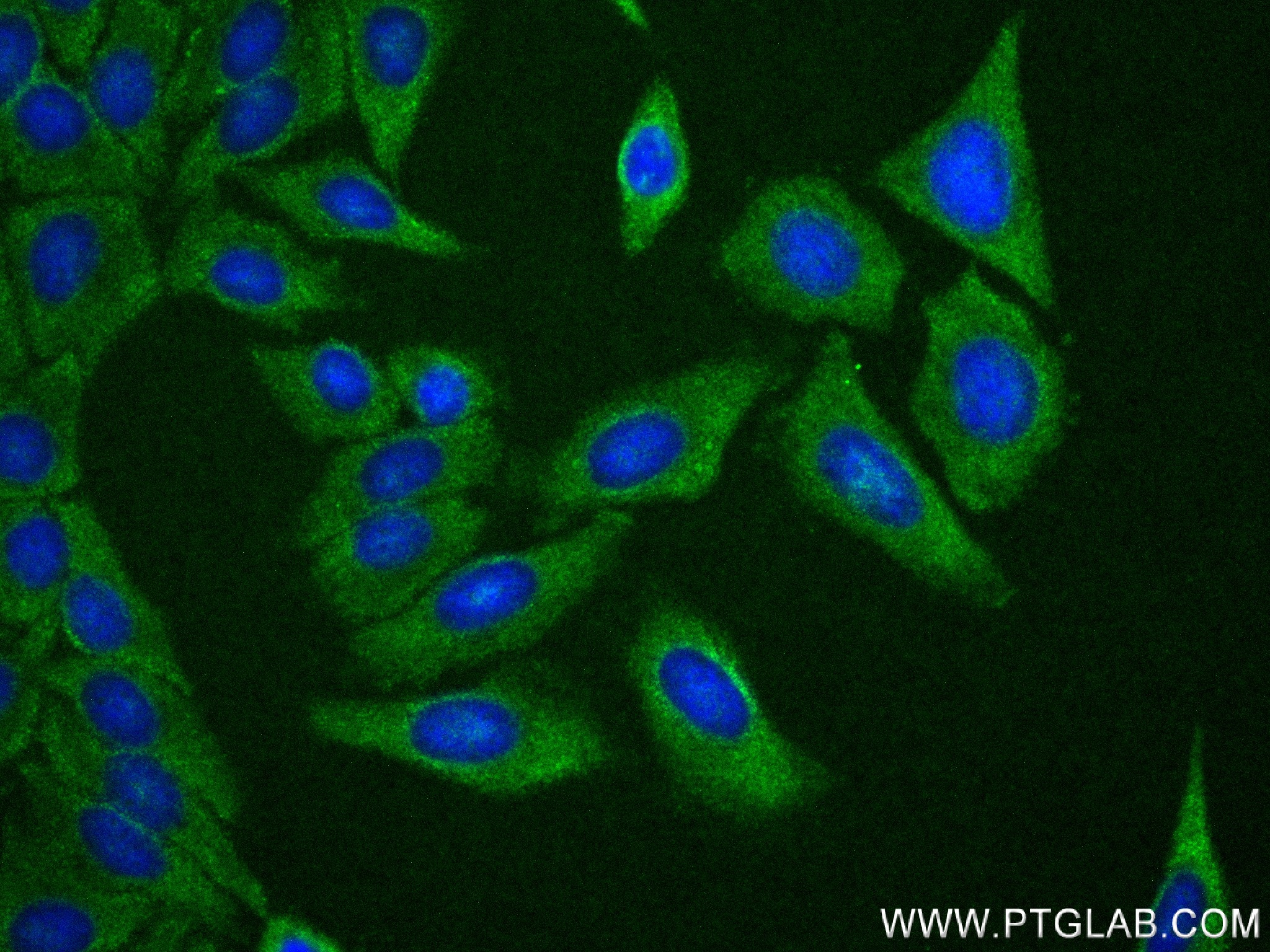 IF Staining of HepG2 using 83950-5-RR (same clone as 83950-5-PBS)