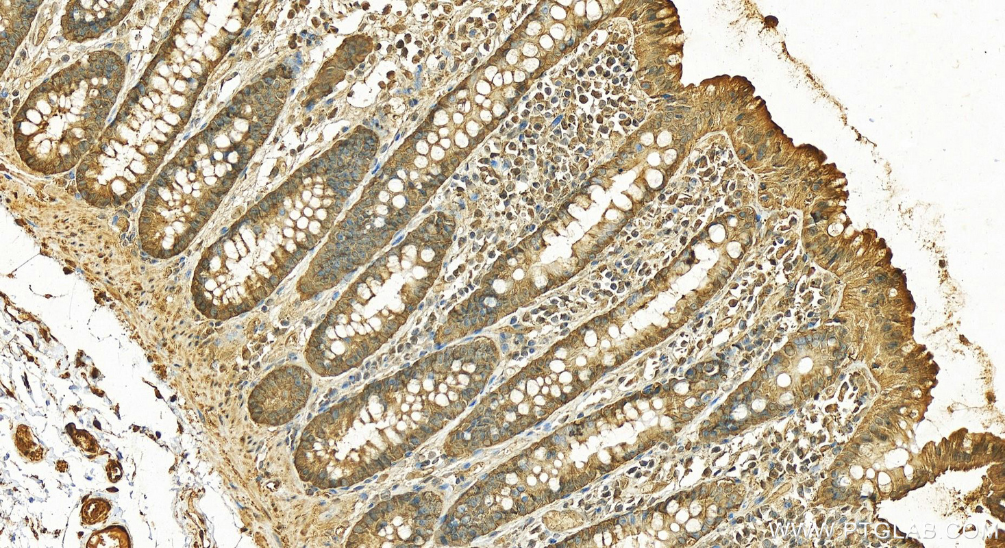 IHC staining of human colon using 11405-1-AP