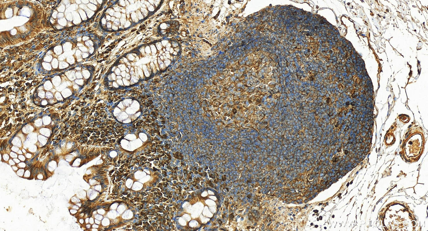 IHC staining of human colon using 10979-1-AP