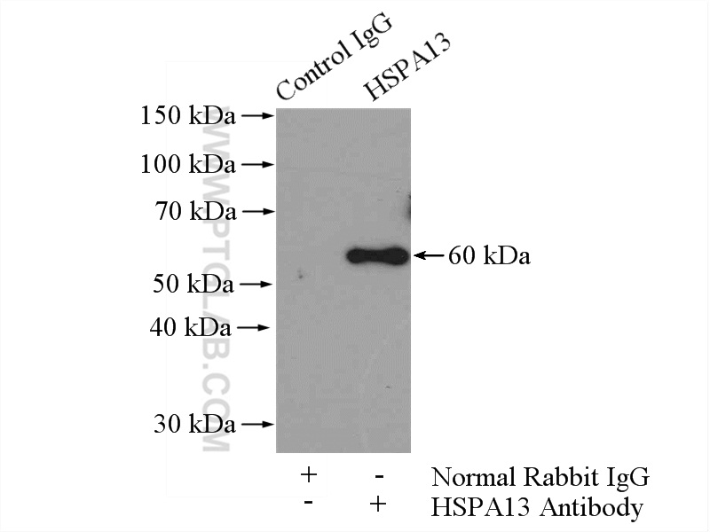 IP experiment of HeLa using 12667-2-AP