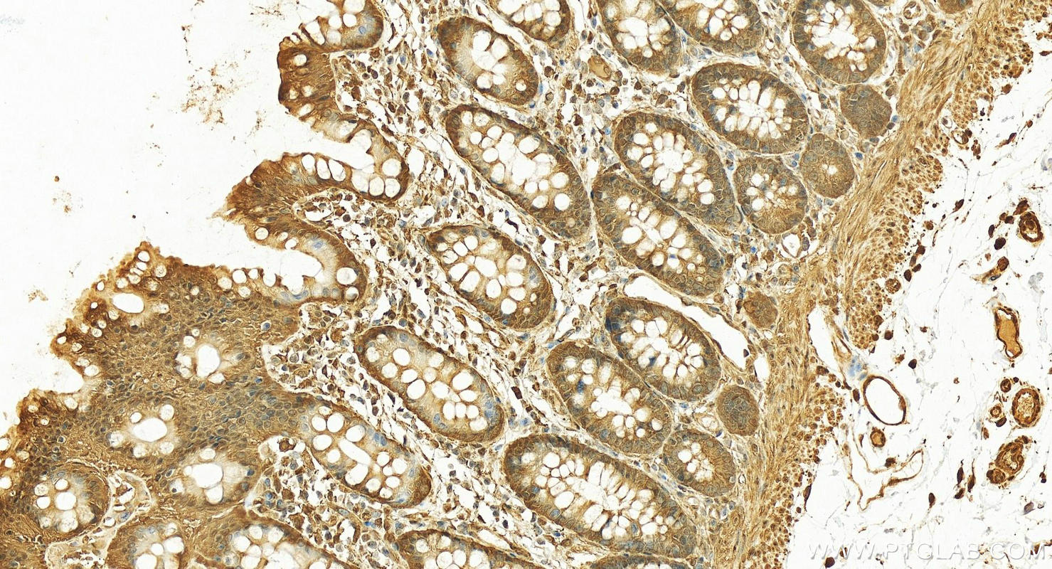 IHC staining of human normal colon using 10995-1-AP