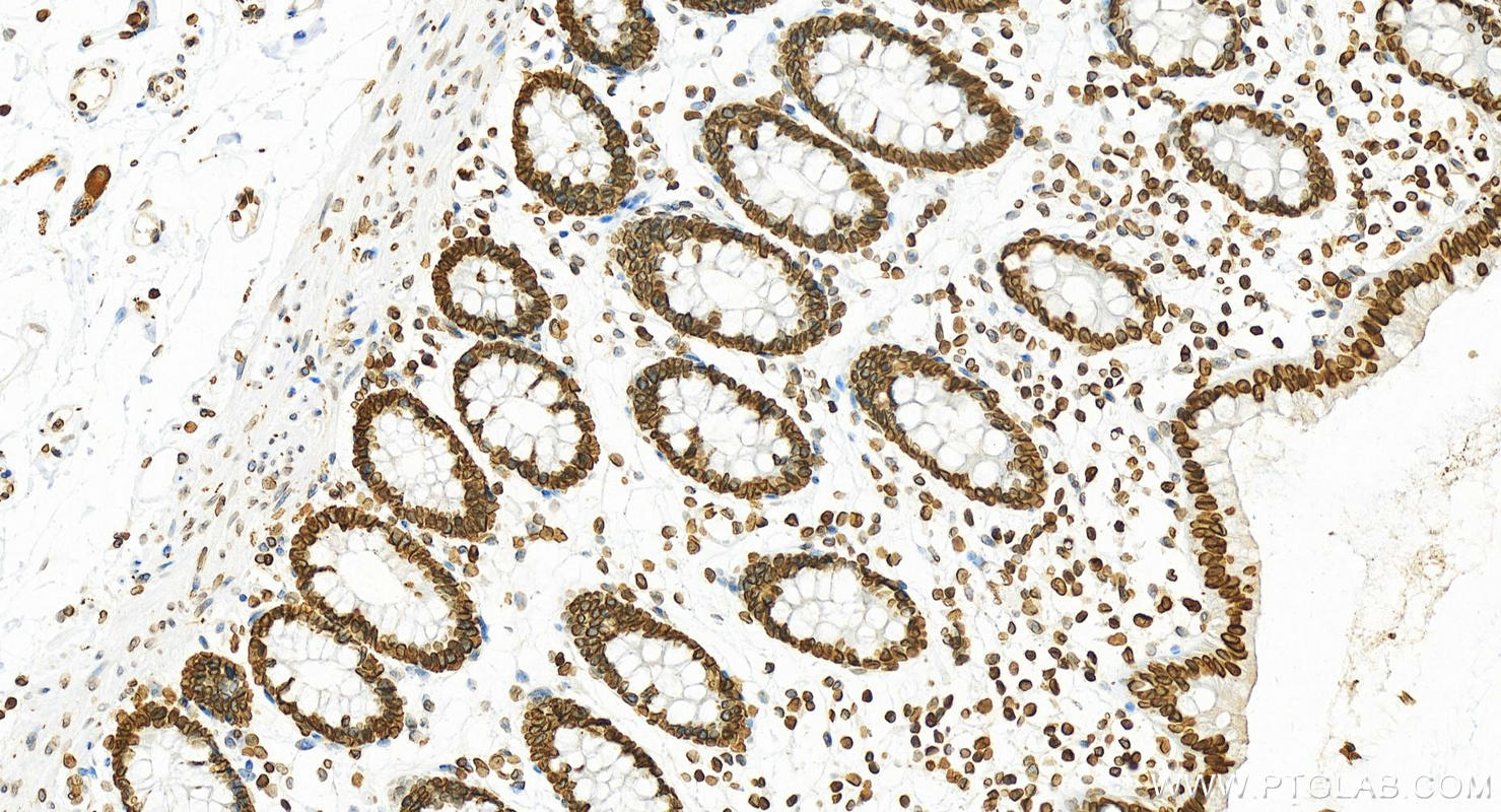 IHC staining of human normal colon using 10995-1-AP