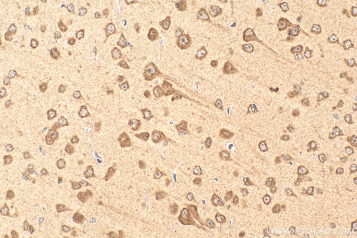 IHC staining of mouse brain using 13970-1-AP