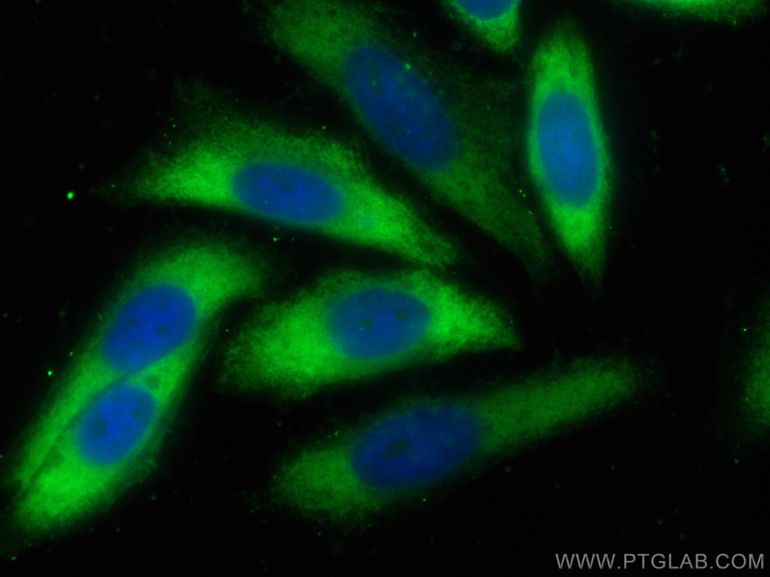 IF Staining of HepG2 using CL488-13970