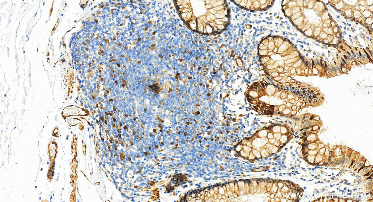 IHC staining of human normal colon using 12797-1-AP