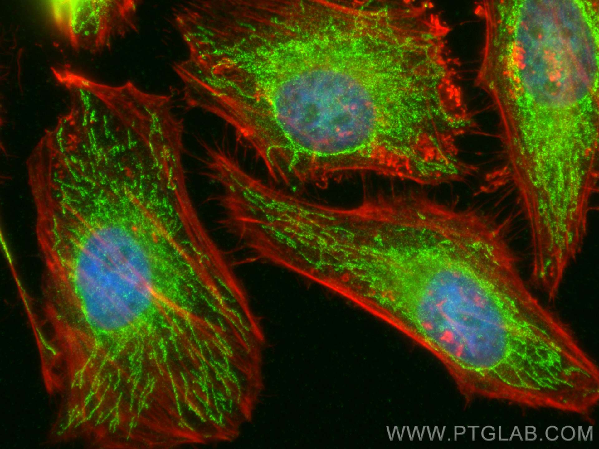 IF Staining of HeLa using 12797-1-AP