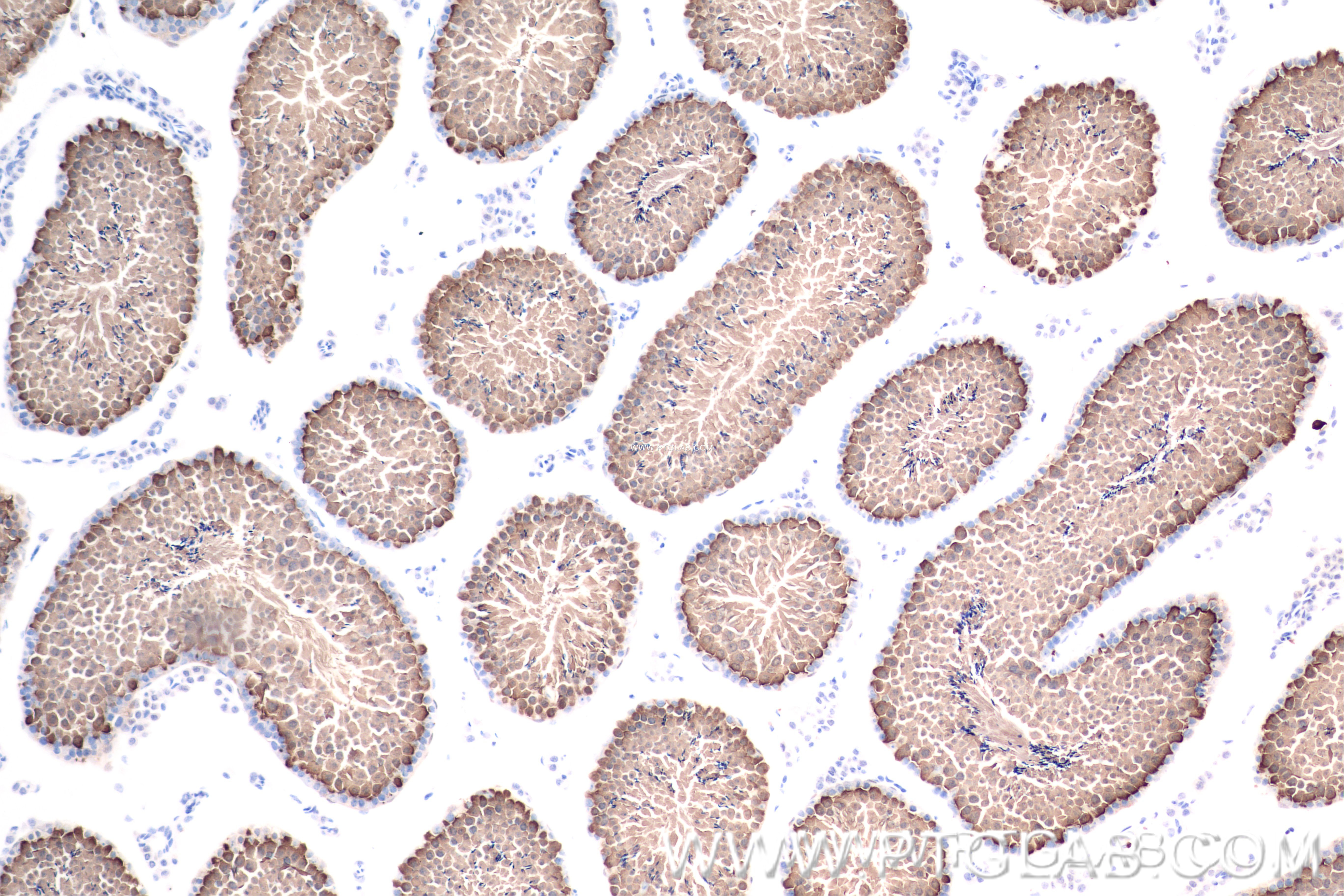 IHC staining of mouse testis using 83466-1-RR (same clone as 83466-1-PBS)