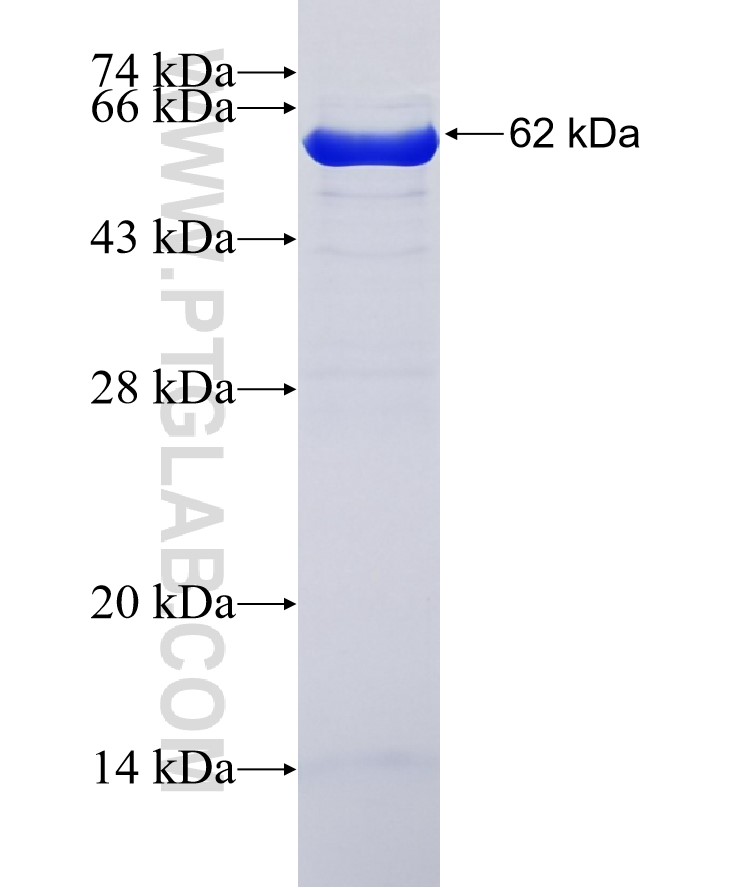 HSPA2 fusion protein Ag3539 SDS-PAGE