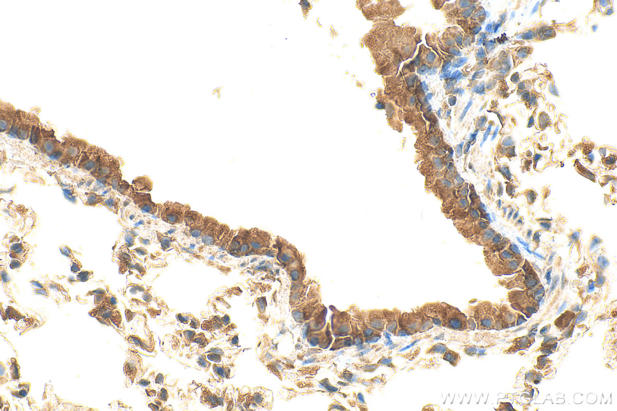 IHC staining of mouse lung using 13616-1-AP