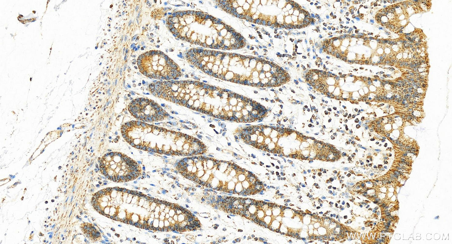 IHC staining of human normal colon using 14887-1-AP