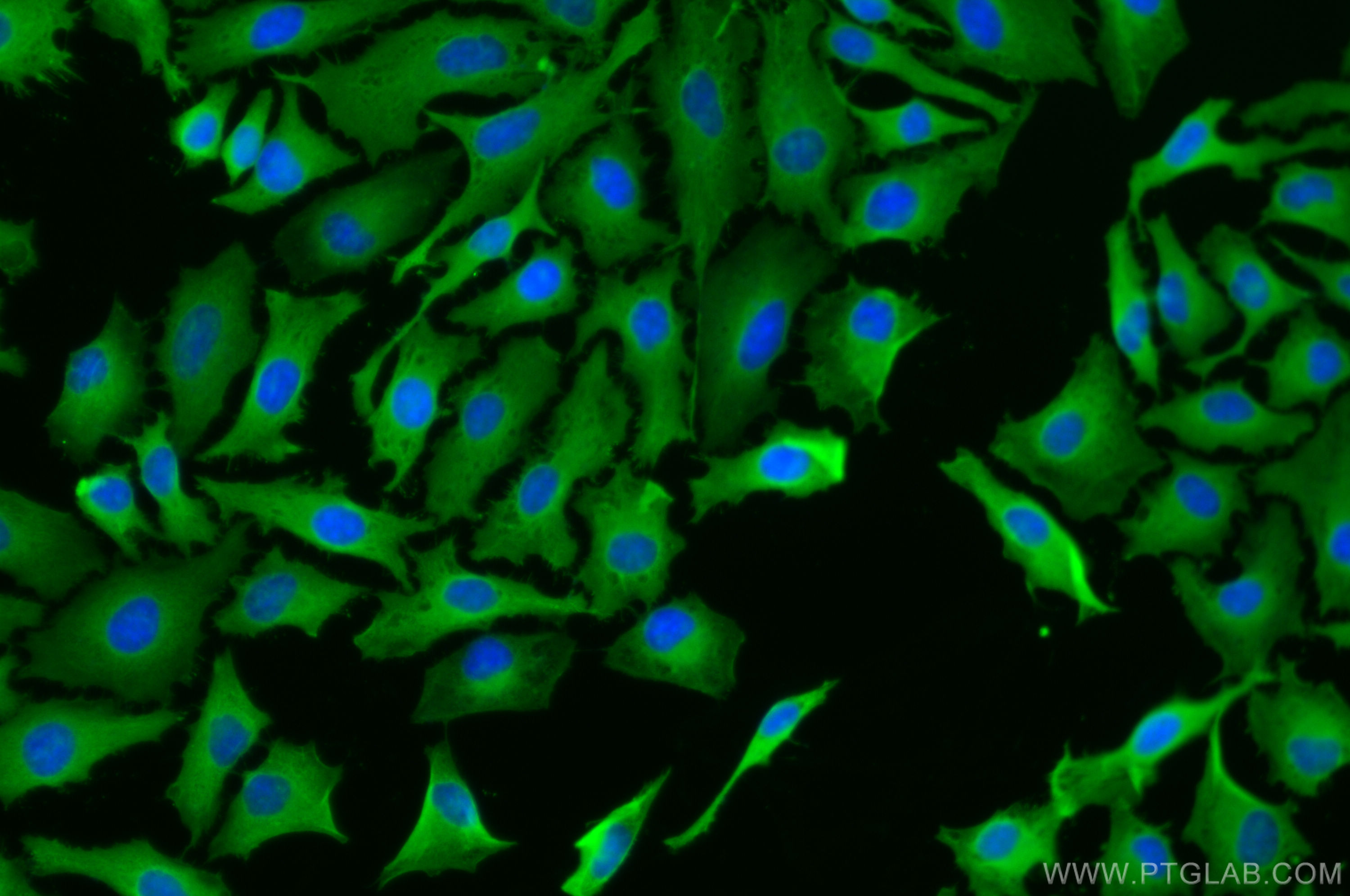 IF Staining of HeLa using 18284-1-AP