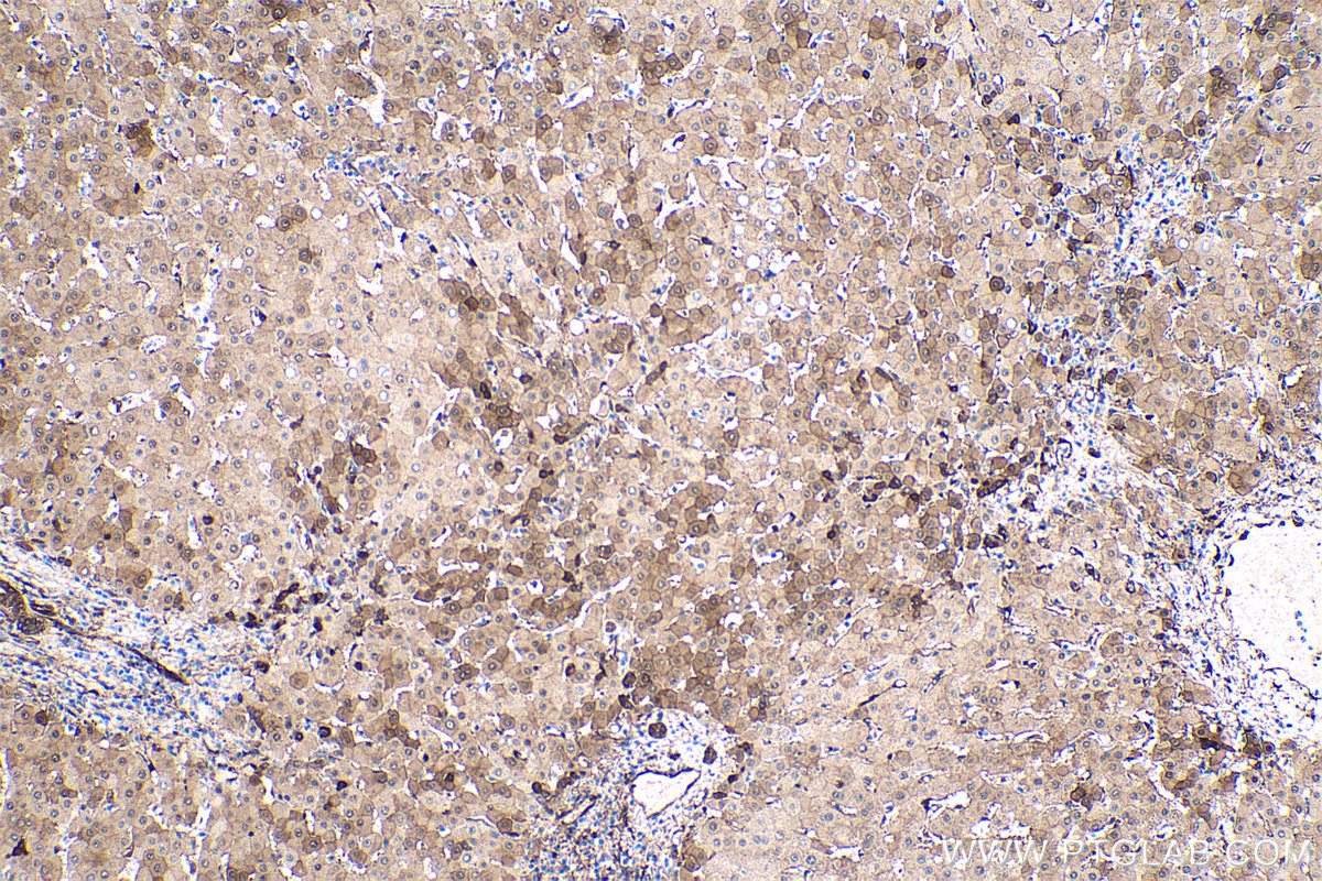 IHC staining of human liver using 66767-1-Ig