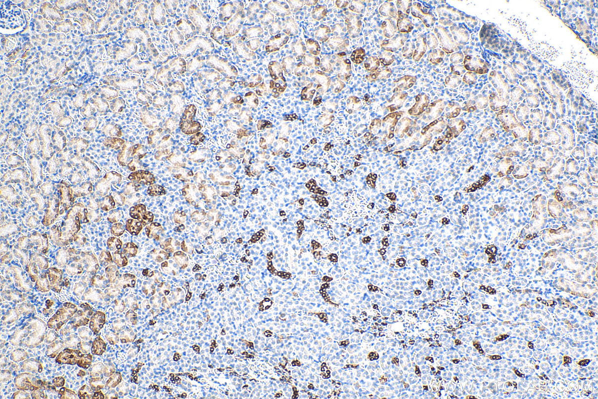 IHC staining of mouse kidney using 67890-1-Ig (same clone as 67890-1-PBS)