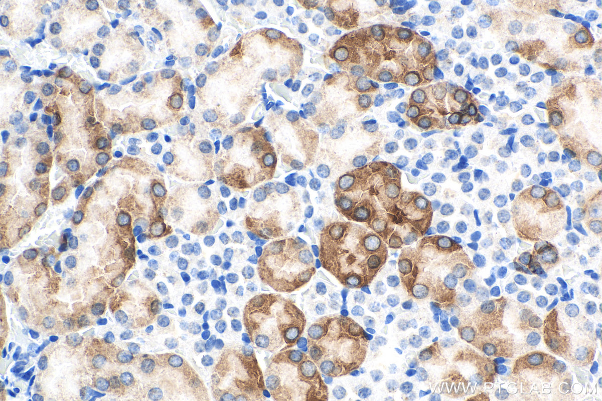 IHC staining of mouse kidney using 67890-1-Ig (same clone as 67890-1-PBS)