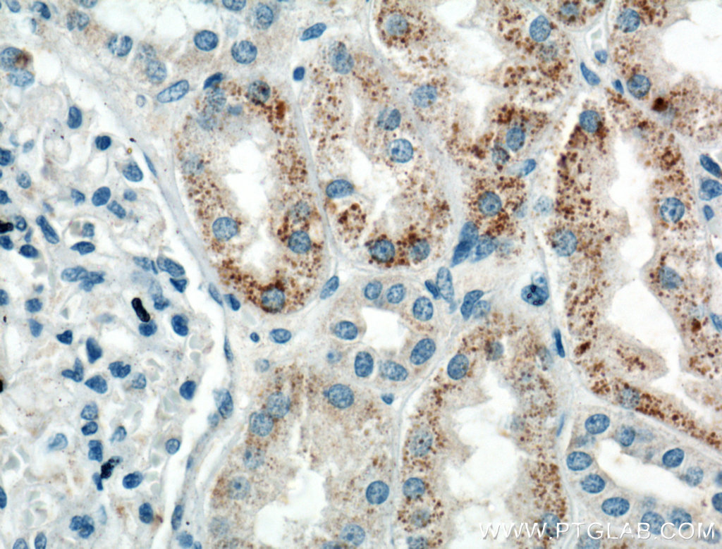 IHC staining of human kidney using 10211-1-AP