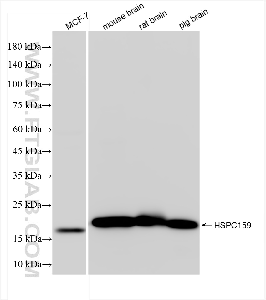 WB analysis using 83983-5-RR (same clone as 83983-5-PBS)