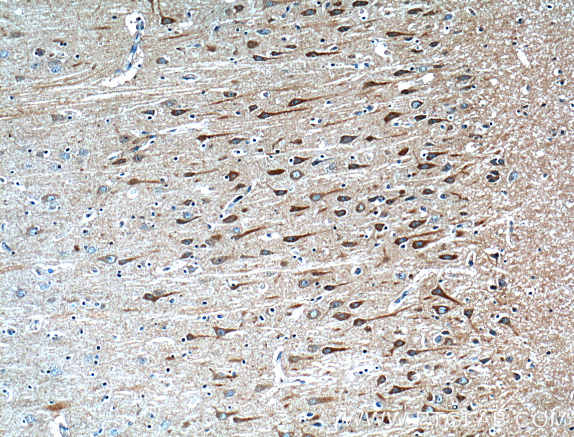 IHC staining of human brain using 13830-1-AP (same clone as 13830-1-PBS)