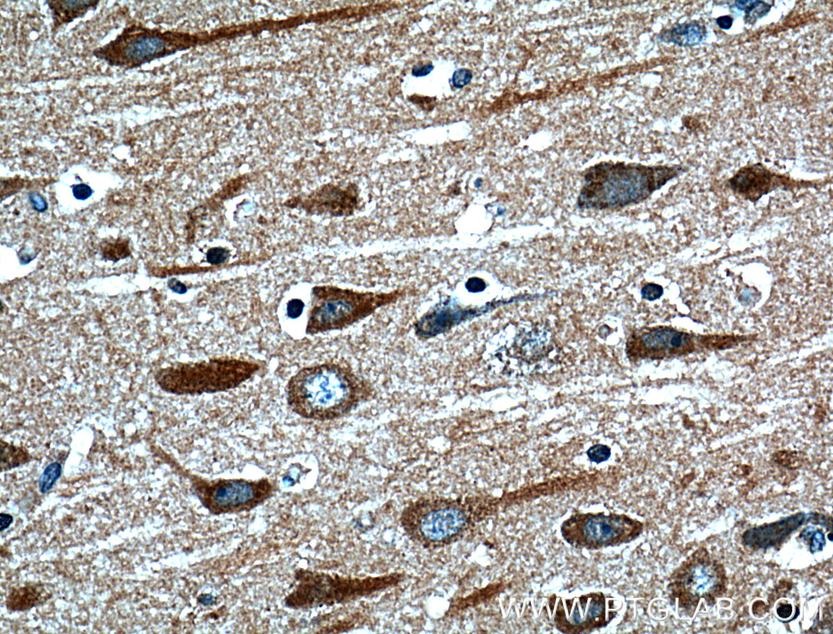 IHC staining of human brain using 13830-1-AP (same clone as 13830-1-PBS)