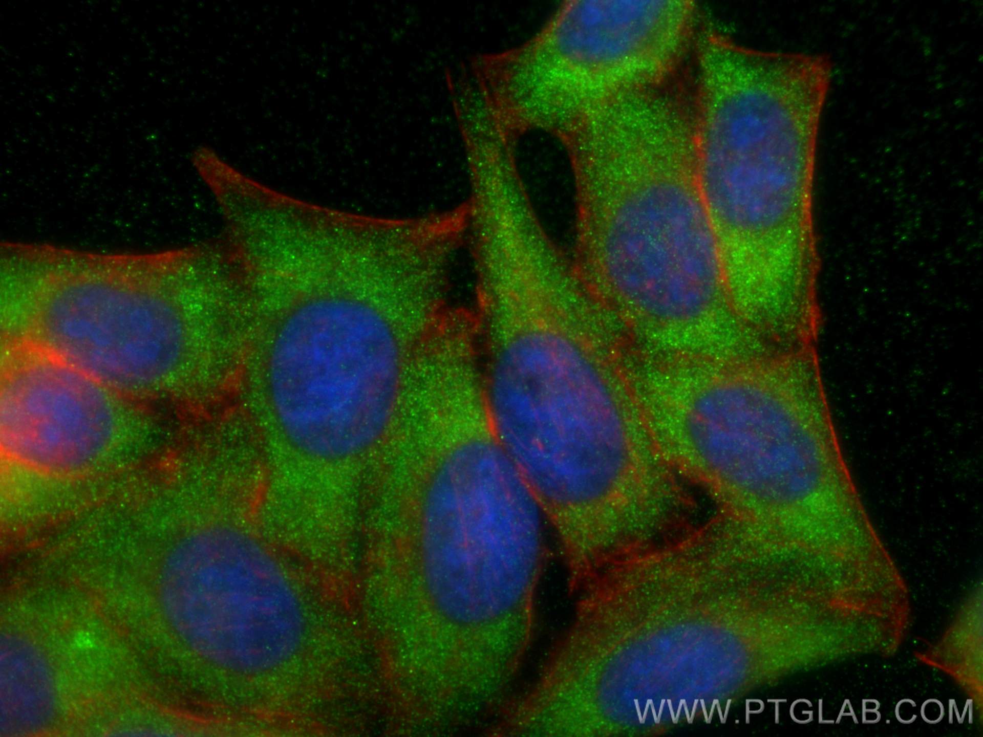 IF Staining of HepG2 using 29618-1-AP