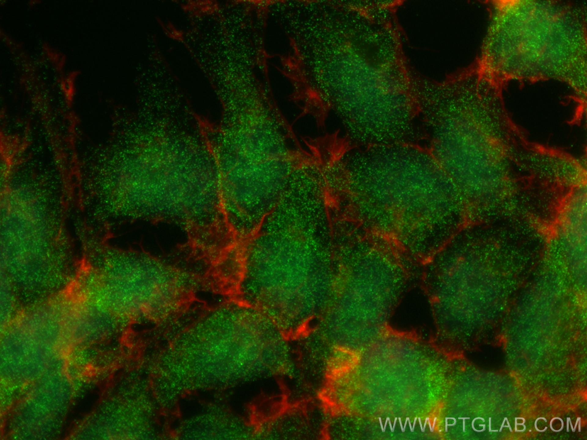 IF Staining of HEK-293 using 19957-1-AP